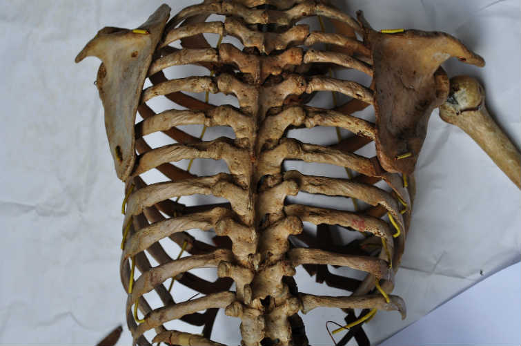Vértebras dorsales Región dorsal de Columna