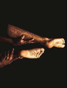 Fibromialgia