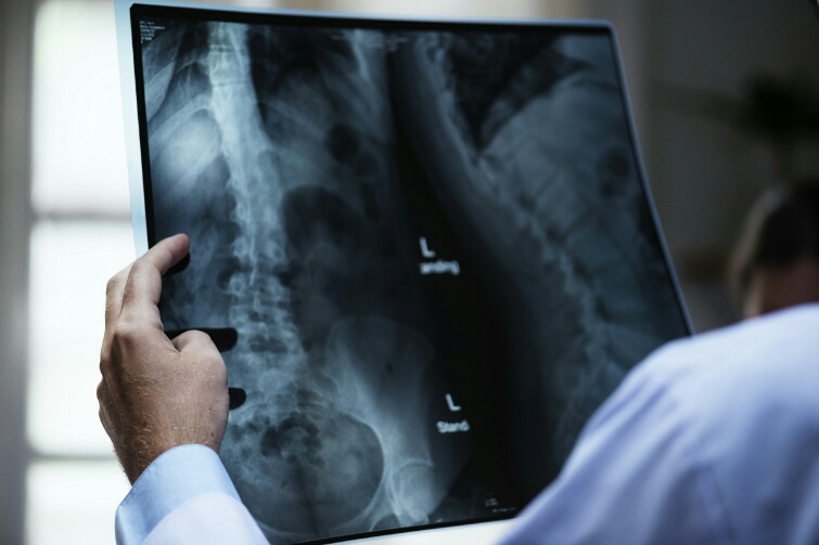 Espondiloartropatia lumbar Lumbalgia inflamatoria espondiloartropatia
