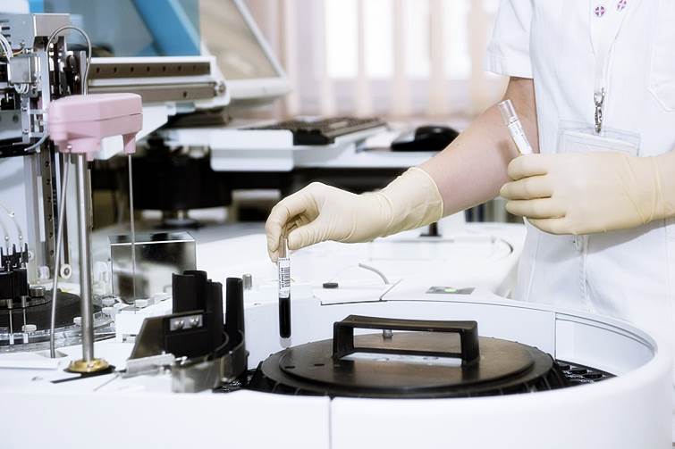 Analítica en la enfermedad de paget Pruebas de laboratorio en la enfermedad de paget