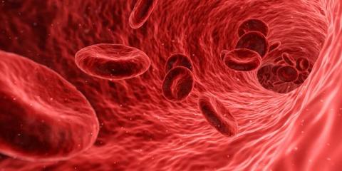 Vasculitis etiopatogenia